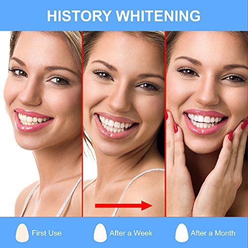 1 Medical Home Teeth Whitening Product PREMIUM Kit with LED Light