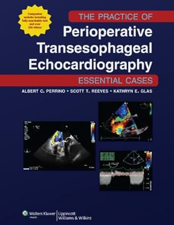 Amazon Com The Practice Of Perioperative Transesophageal
