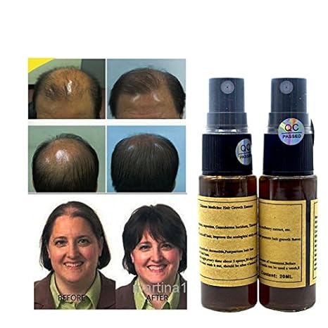 Buy Yuda Pilatory Hair Regrowth Oil For Men And Women 2pcs Set