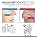 Rejuvenation Anti Snoring Device - Snoring Solution -New 2018 Ergonomic Design is The Perfect Snoring Solution