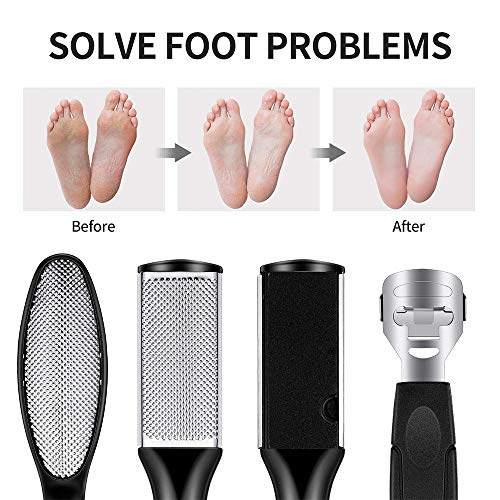 Faraone4w 21 en 1 kit de limas para pedicura profesional para eliminar callos, piel muerta y otros cuidados de pies para mujeres y hombres en el hogar