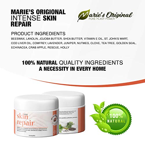 Vitamin E Ointment For Burns