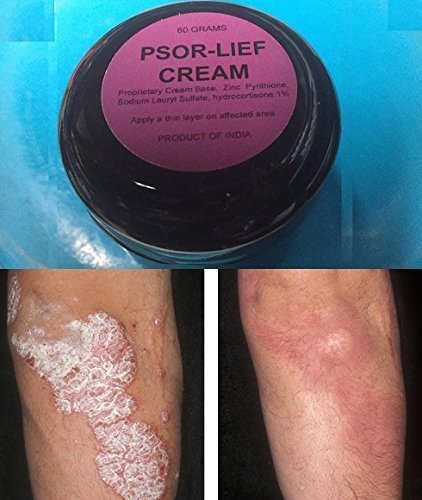 Psor-Lief Cream 60 Grams Control Psoriasis Symptoms Best Psoriasis Product