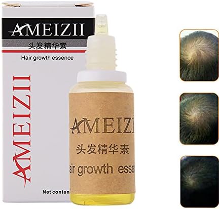 Hair Growth Essence Hair Loss Treatments Hair Loss Stop Fast Hair Growth Products RegrowGinger Genseng Raise Dense Hair 20ml