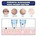 Blackhead Remover Blackhead Vacuum Microdermabrasion Machine Facial Pore Cleanser Blackhead Acne Removal Powerful Extractor With 4 Replaceable Suction Heads (Pore Cleanser-873-white)