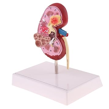 MagiDeal Medizinische Lernwerkzeug - Menschliche 2-seitig Niere Anatomisches Modell für Anatomie Hilfsmittel
