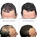 Hair Building Fibers Natural Hair Loss Concealer for Men and Women 0.87oz -(Black)