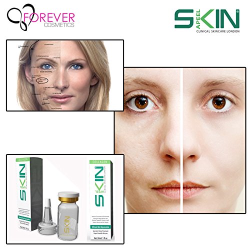 View 4