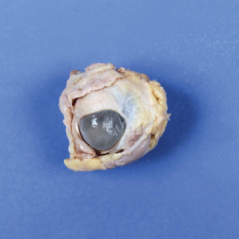 Perfect Solution Preserved Sheep Eye Plain Pail Science Classroom Specimens Amazon Com Industrial Scientific