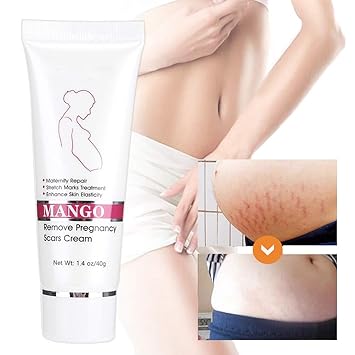 stretch mark removal amazon