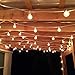 Monkeydg 100FT Globe String Lights G40 with 102 Clear Bulbs Indoor Outdoor Patio,Market,Cafe,Garden,Birthday,Wedding Backyard String Lights-5 Watt/120 Voltage/E12 Base -White Wire