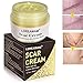 Scar Removal Cream,Scar Cream,Scar Treatment,Skin Repair Cream,Treatment for FaceBody Scar,Acne Spots,Stretch Mark Cream, Old and New Scars and Surgical Scars,For Men & Women 50ml
