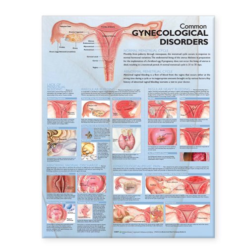Common Gynecological Disorders Anatomical Chart, Small