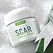 Amada Pure Scar Removal Cream - Acne Scar Removal Cream for Face and Body, Old & New Scars from Cuts, Stretch Marks, C-Sections & Surgeries - with Natural Herbal Extracts Formula - (30 ml)