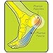 ProFoot Plantar Fasciitis Heel Insert Men's, 1 pair (Pack of 4)