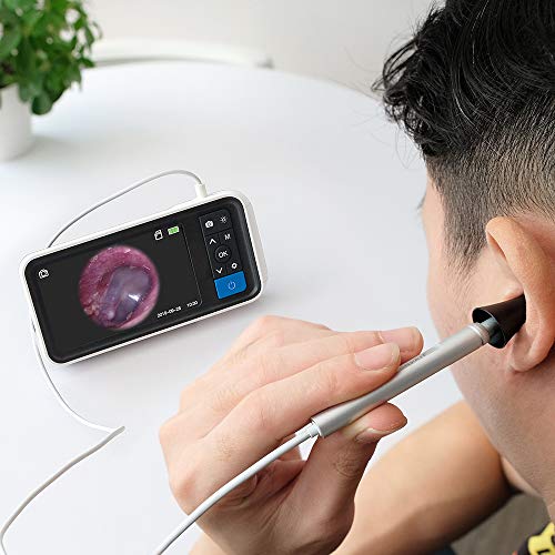 Digital Otoscope with 4.5 Inches Screen, Anykit 3.9mm Ear Camera with 6