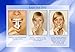 Facelifter Most effective facial exerciser to build jawline and improve facial features. Highest resistance and safety. Easy use - 2 min/day.