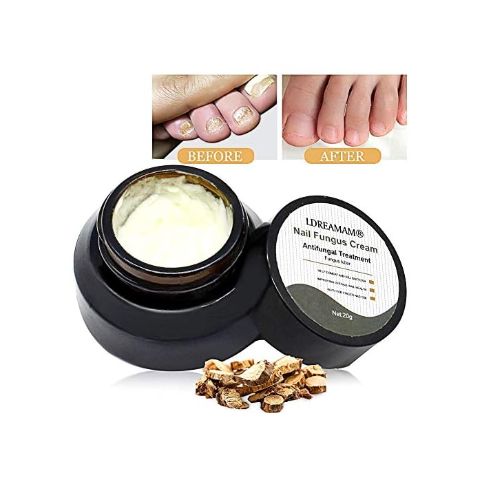Nail Fungus Cream,Fungus Stop,Foot Fungus,Anti fungal Nail,Fungus Treatment Cream,Foot & Nail Fungus Treatment,Effective…