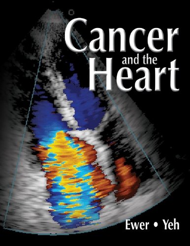CANCER AND THE HEART