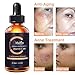 Vitamin C Serum for Face, 2019 Hyaluronic Acid Serum, Acne Clarifying Serum 20% Hyaluronic Acid, Anti Aging Serum ,Wrinkle Serum,Dark Spot Remover, Facial Pure Serum for Women & Men