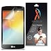 XShields© (5-Pack) Screen Protectors for LG Transpyre VS810PP (Ultra Clear)