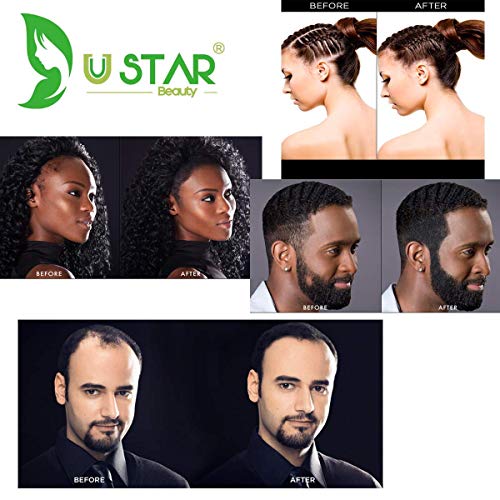 Ustar Hair building Fibers Hair Loss Concealer for Thinning Hair Auburn 0.42oz 12g