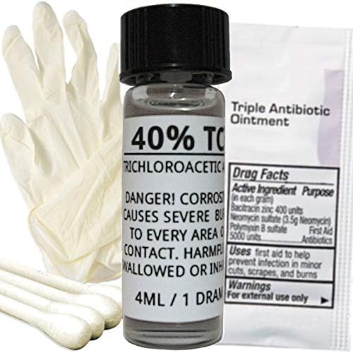 TCA Skin Peel Kits - Professional Strength - Remove Tattoos, Age Spots, Stretch Marks, Acne Scars, Moles, Scars, Skin Tags, Hyperpigmentation, Wrinkles & Freckles! (40)