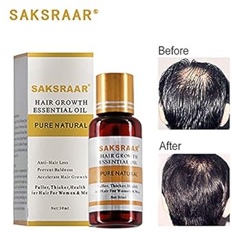 Buy Beautymiss Fast Hair Growth Faster Grow Hair Regrowth For Men