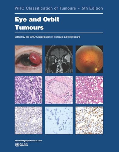 Haematolymphoid Tumours: WHO Classification of Tumours
