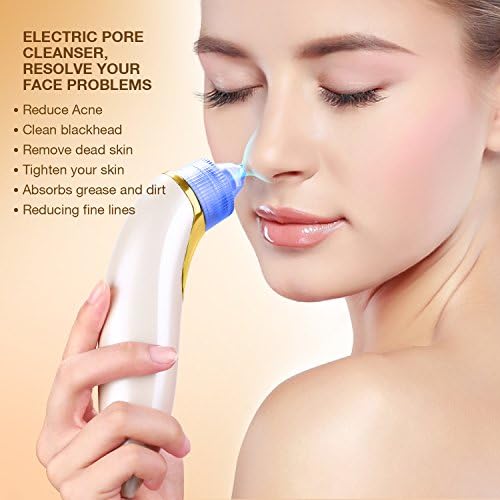 Electric Blackhead Remover, Acne Vacuum Suction Facial Pore Cleanser Cleaner MintBear Comedo Extraction Tool with 4 Microcrystalline Head and USB cable (Luxury Gold)
