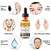 Vitamin C Serum for Face to Boost Collagen with Hyaluronic Acid and Retinol - USA Made Anti-Aging Facial Serum - Best Anti Wrinkle Solution for Younger and Brighter Skin