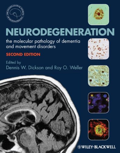 Neurodegeneration - The Molecular Pathology of Dementia and Movement Disorders 2e