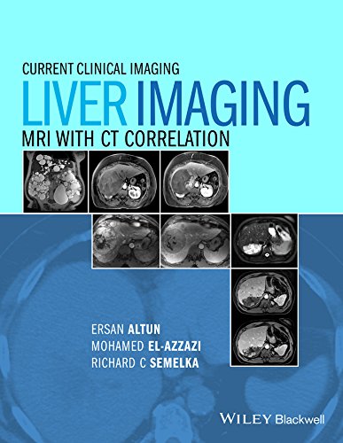 Liver Imaging: MRI with CT Correlation
