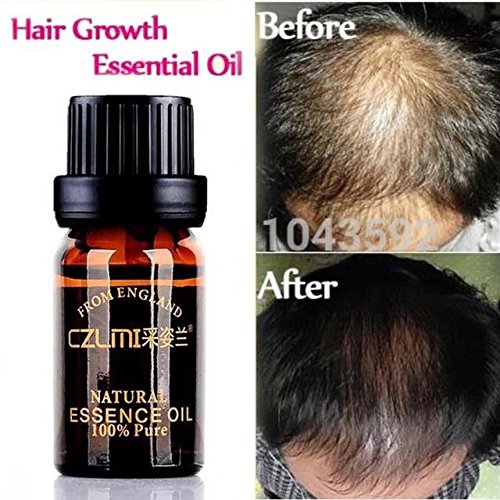 Buy Generic Hair Loss Natural Growth Treatment Men Regrowth