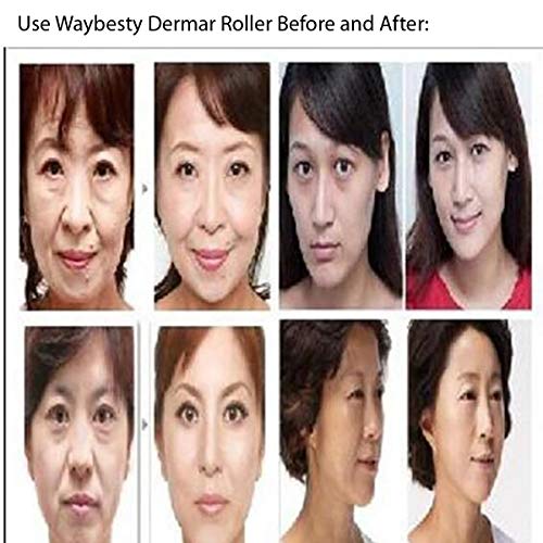 Derma Roller Kit for Face 0.25mm - Microneedle Roller Microdermabrasion Device Tool -Mini Skin Care 540 Titanium Micro Needles Roller System with Gift Box and Crystal Case (0.25mm, Black&Blue)
