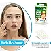 MEDca Acne Patches for Face - Hydrocolloid Bandages (36 Count) Pimple Patches for Face in 2 Universal Sizes, Acne Spot Treatment Care for Face & Skin Spot Patch Conceals Zits, Acne and Blackheads