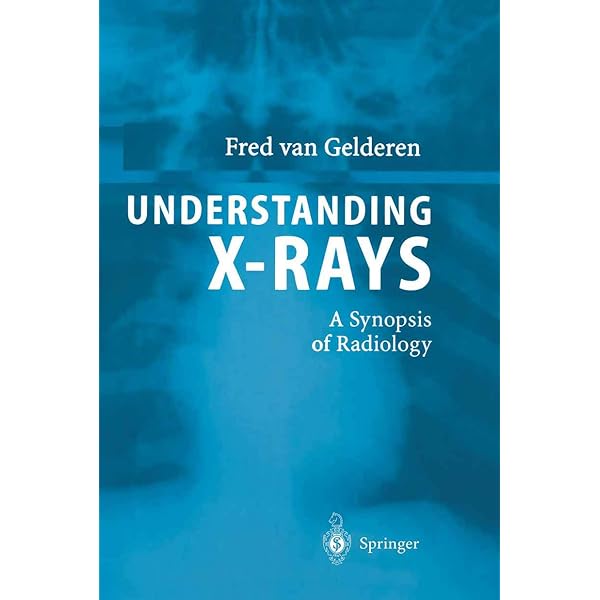 Understanding X-Rays: A Synopsis of Radiology: 9783540001379
