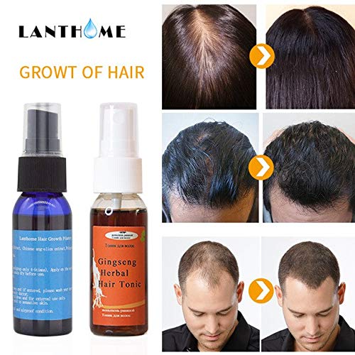 Buy Shoppy Shop Women Men Hair Care Growth Oil Treatment Hair