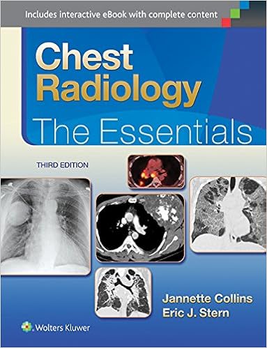 Chest Radiology The Essentials Essentials Series 9781451144482 Medicine Health Science Books Amazon Com