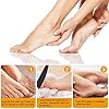 Foot Files for Hard Skin –Professional Pedicure Set [Pack of 15] Foot File Set, Stainless Steel Foot File Clean Foot…