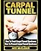 Carpal Tunnel: How To Treat Carpal Tunnel Syndrome: How To Prevent Carpal Tunnel Syndrome (Pain Relief & Treatment for Carpal Tunnel Syndrome)