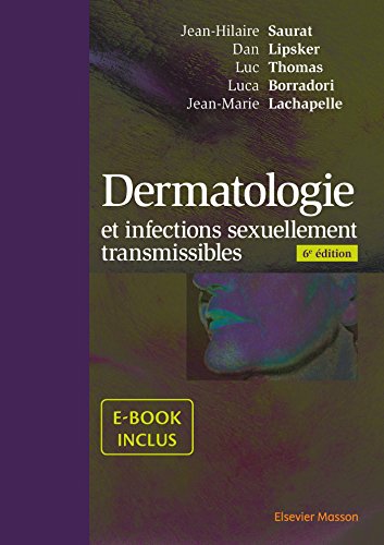 Télécharger Dermatologie Et Infections Sexuellement - 