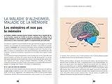 Image de se prevenir d'alzheimer