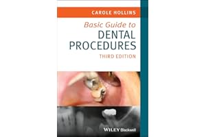 Basic Guide to Dental Procedures (Basic Guide Dentistry Series)
