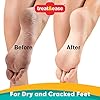Foot-Heel-Moisturising-Balm-x-2units-Foot-Cream-for-Dry-Cracked-Heels-Hard-Skin-Callus-Balm-Includes-Health-Care-Home-First-Aid-E-Book Foot & Heel Moisturising Balm x 2units