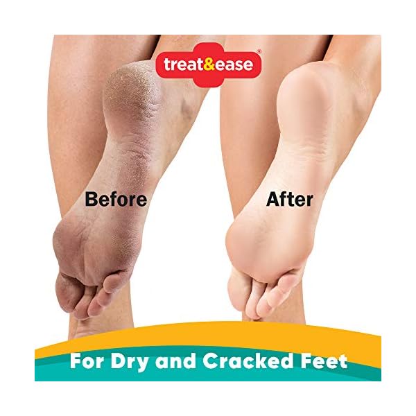 Foot-Heel-Moisturising-Balm-x-2units-Foot-Cream-for-Dry-Cracked-Heels-Hard-Skin-Callus-Balm-Includes-Health-Care-Home-First-Aid-E-Book Foot & Heel Moisturising Balm x 2units