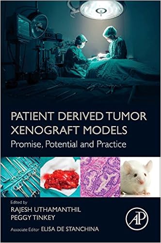 Patient Derived Tumor Xenograft Models: Promise, Potential and Practice