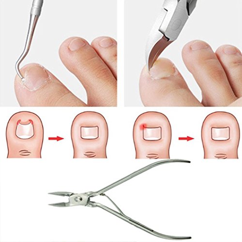AutumnFall Nail Clipper,2Pcs/Set Ingrown Toe Nail Correction Nippers Clipper Cutters Dead Skin Dirt Remover + Paronychia Podiatry Pedicure Care Tool (Silver) - Thumbnail 2