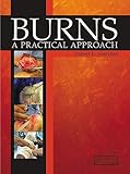 Burns: A Practical Approach to Immediate Treatment