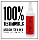 Seriously, the Best Hair Growth Treatment for Widow's Peak and Crown